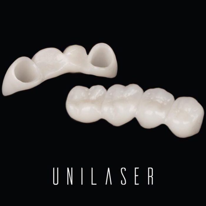 Types of dental bridges, complete guide from UNILASER in Medellin