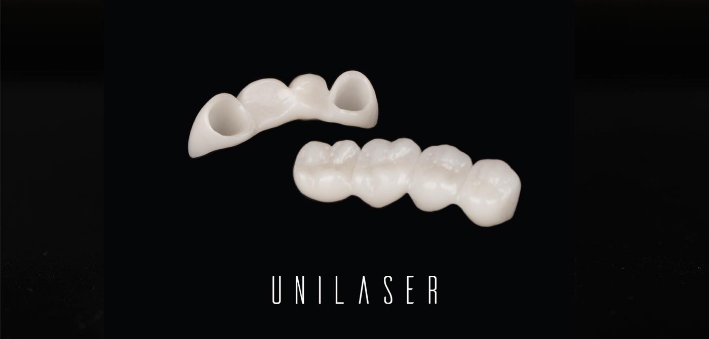 Types of dental bridges, complete guide from UNILASER in Medellin