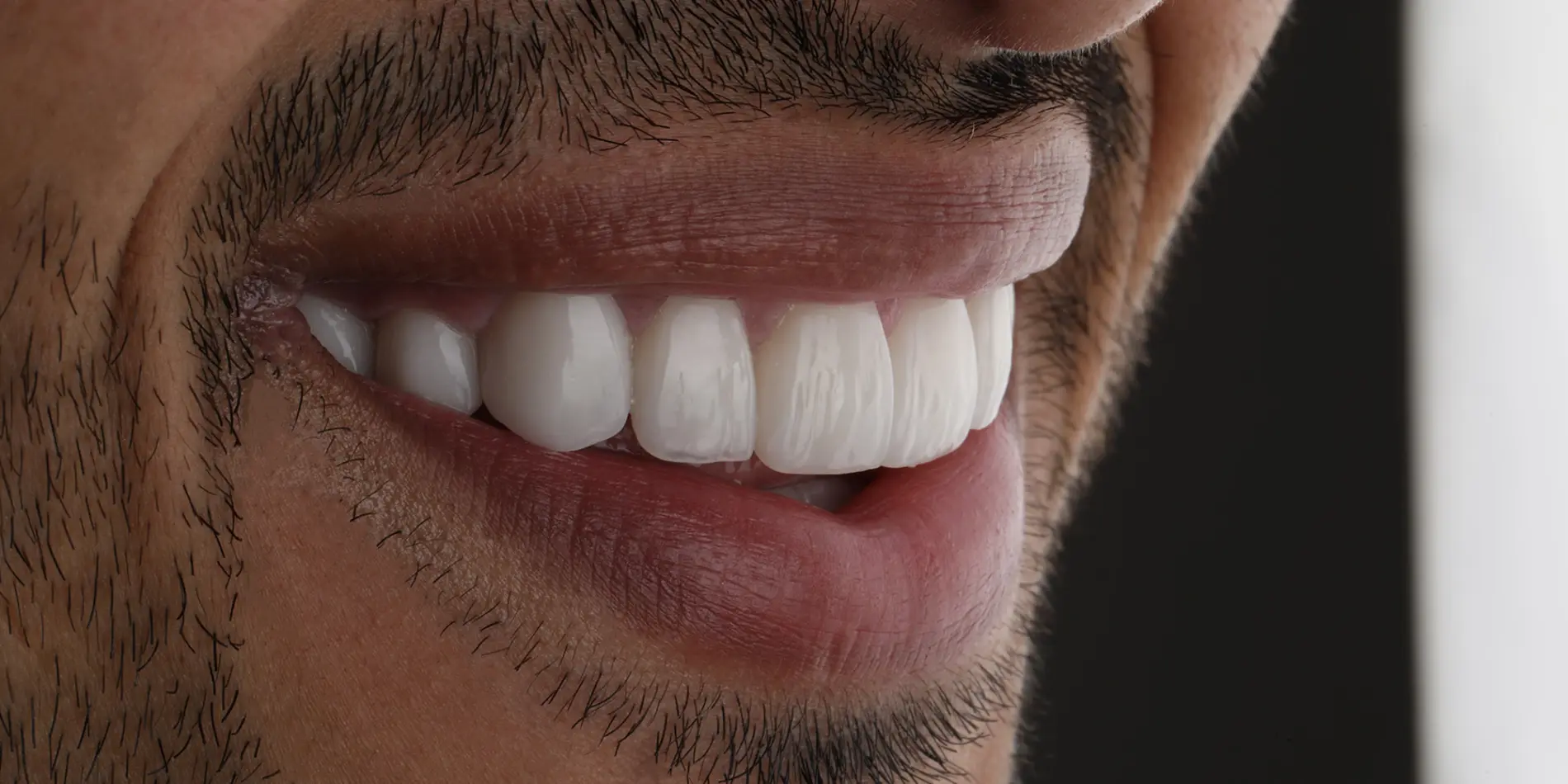 Diagnóstico dental online Unilaser Medellín
