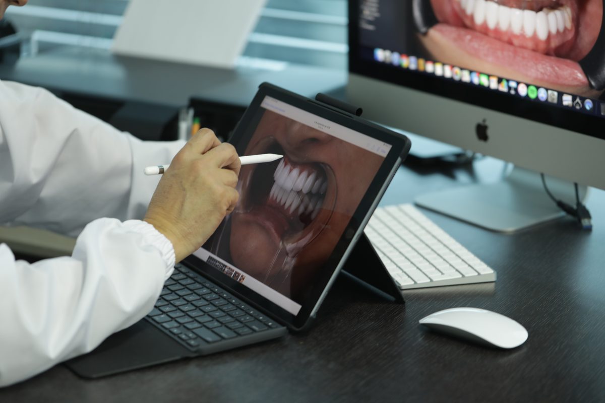 Planificación digital de diseño de sonrisa en Unilaser