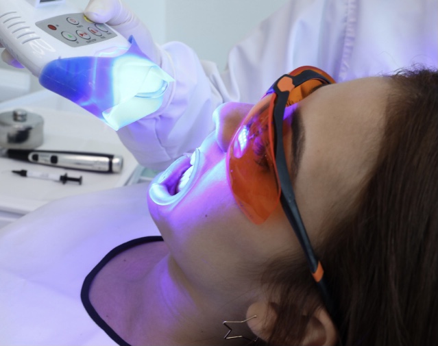 Blanqueamiento dental como parte de un diseño de sonrisa