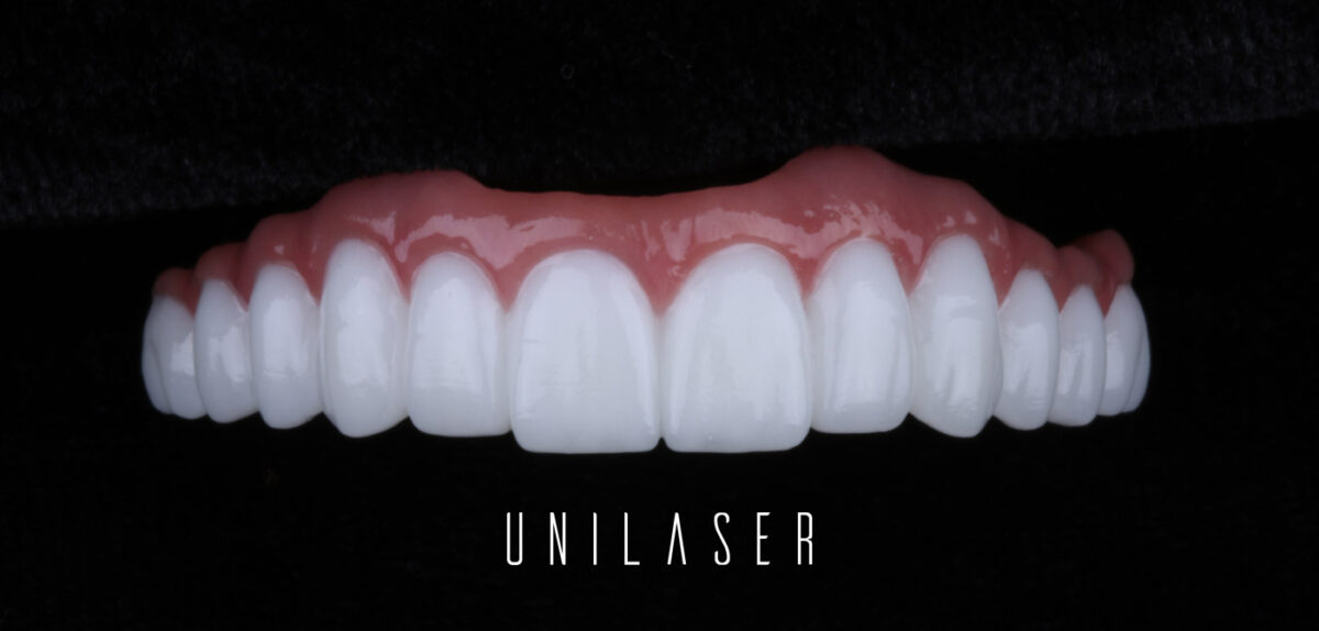 ¿Cómo cuidar tus implantes dentales?