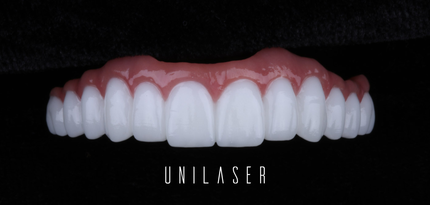 ¿Cómo cuidar tus implantes dentales?