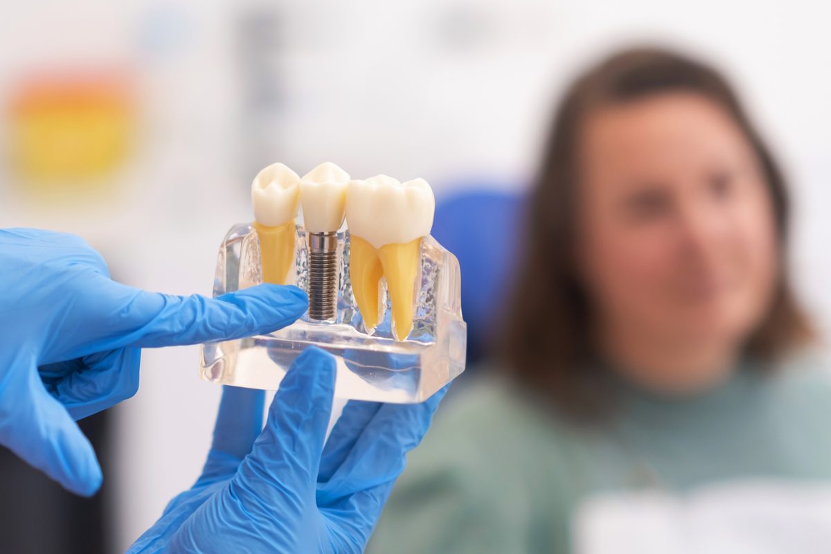 Odontólogo explicando cuidados de implantes dentales a paciente
