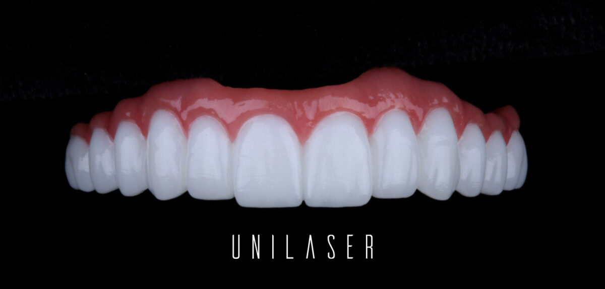 How to care for your dental implants?