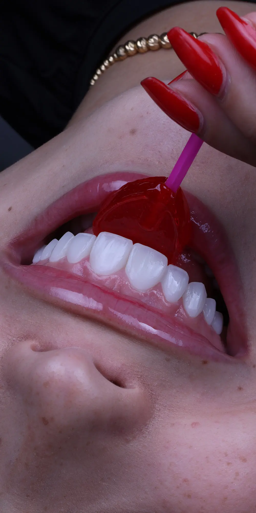 ¿Qué es el diseño de sonrisa?