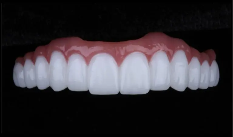 Implantes dentales Medellín Colombia Unilaser