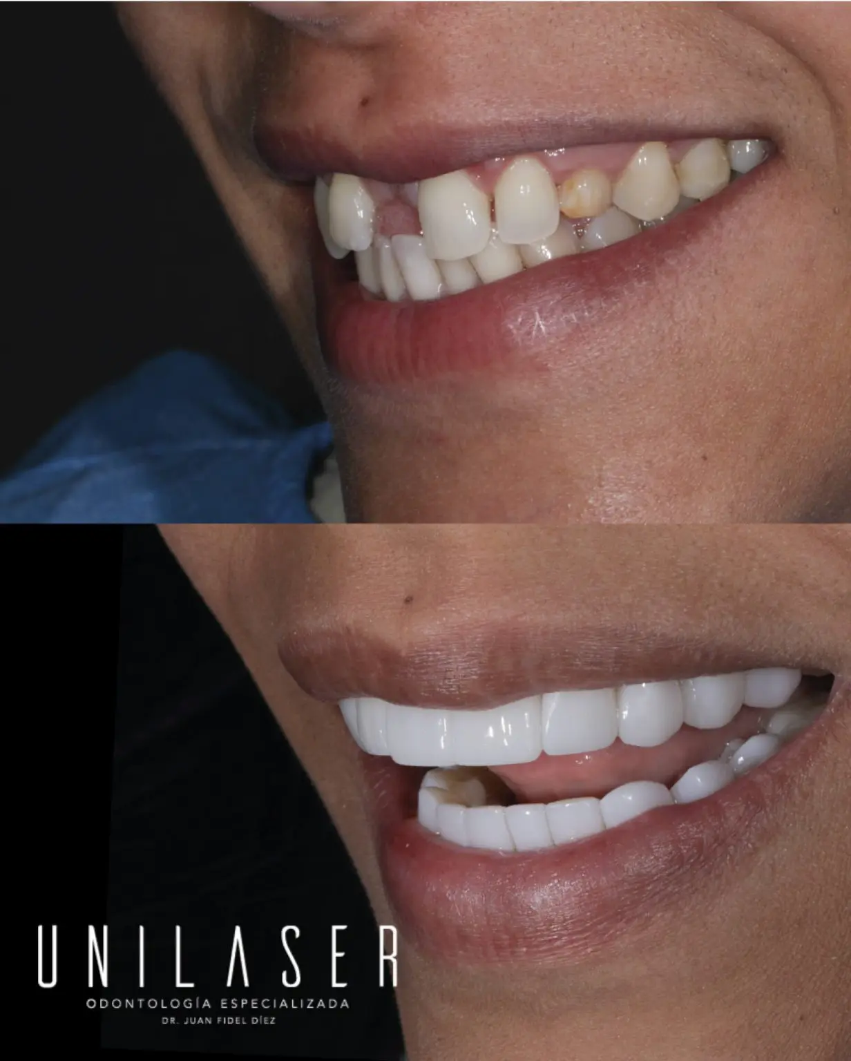 ¿Qué síntomas o afecciones trata la endodoncia?