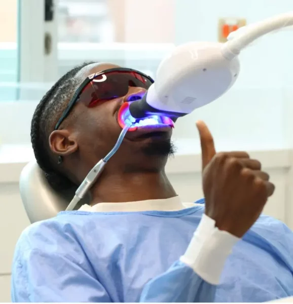 Blanqueamiento dental combinado Medellín Colombia Unilaser
