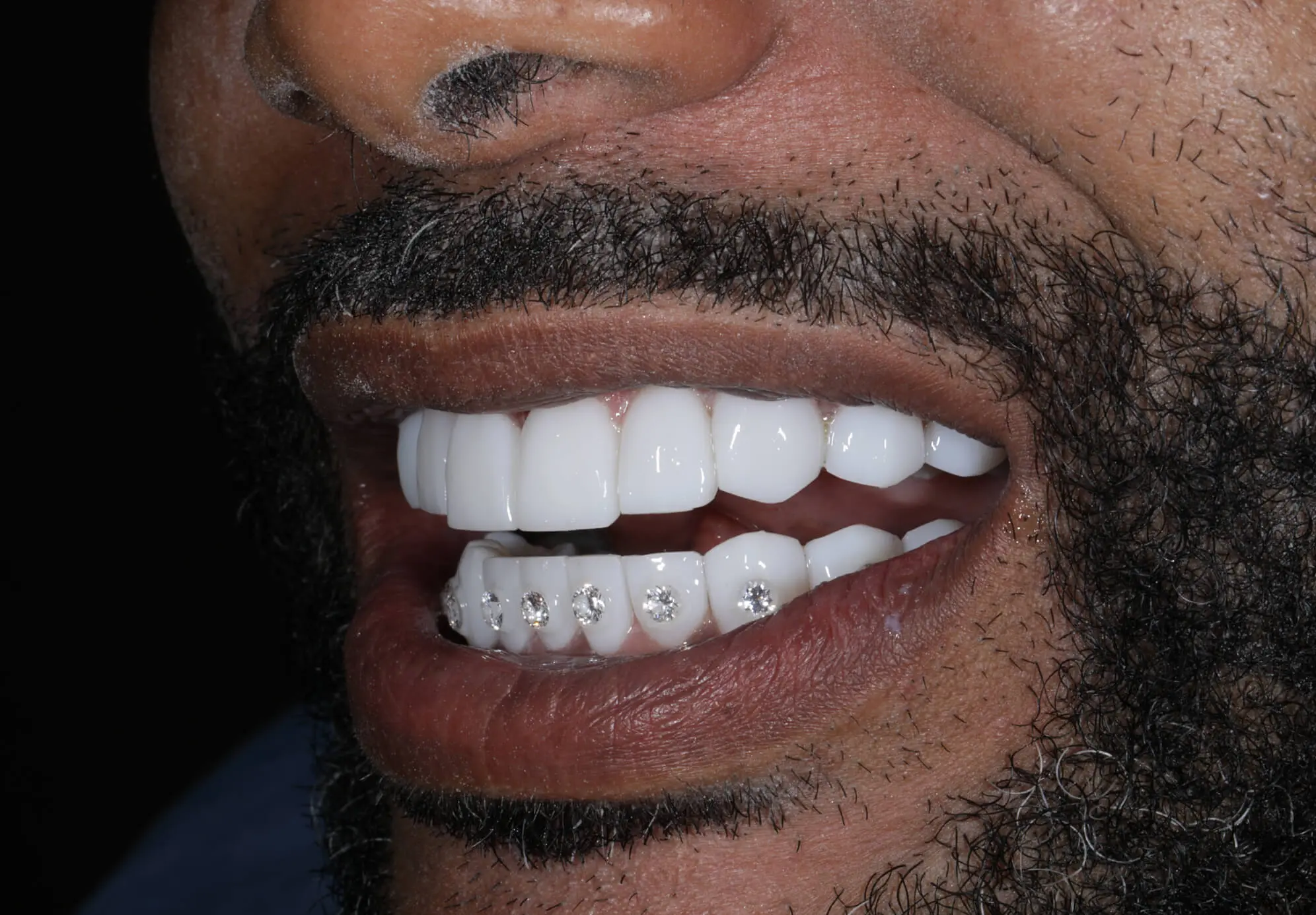 Endodoncia en Medellín