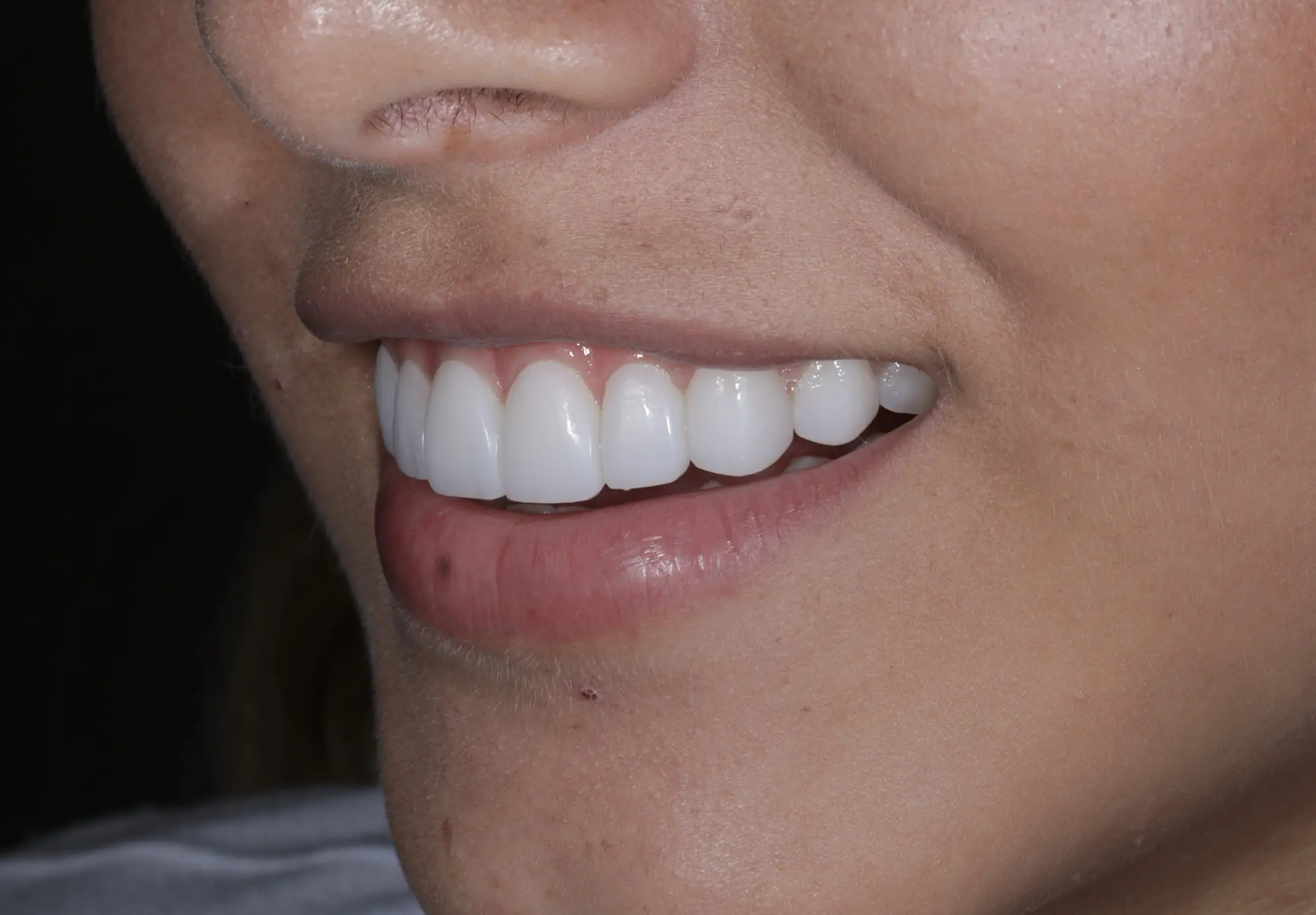 Periodoncia en Medellín