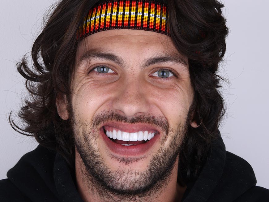 Tratamientos comunes en un Diseño de Sonrisa