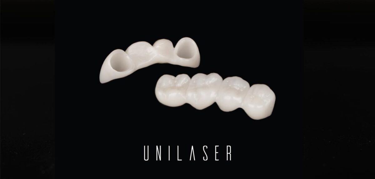 Tipos de puentes dentales en Unilaser